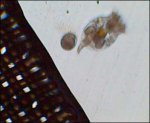Brachionis 80x vergroot met een zeef van 40micron - focus op zeef.jpg